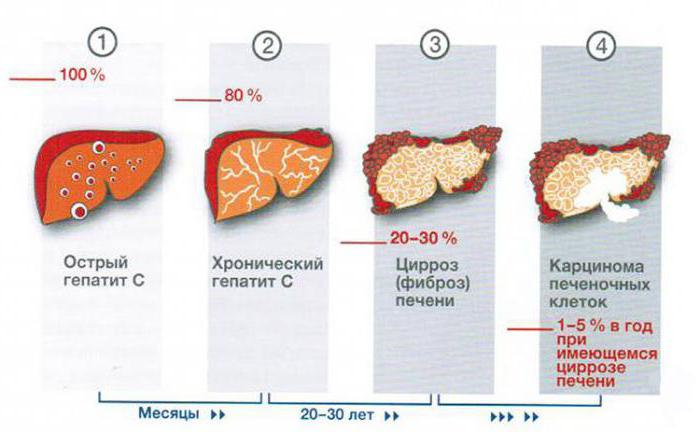 куда обращаться с гепатитом С