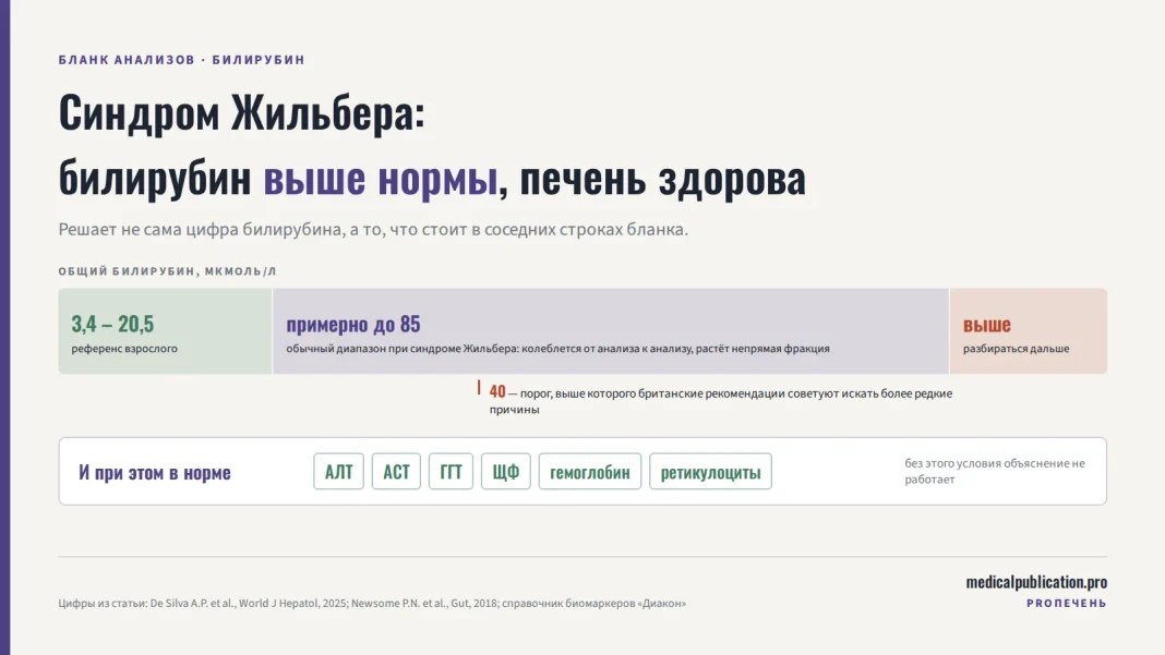 Числовая шкала общего билирубина в мкмоль/л: зелёная зона референса 3,4–20,5, широкая фиолетовая зона обычного диапазона при синдроме Жильбера примерно до 85, красная зона выше; отметка на 40 и карточка с показателями АЛТ, АСТ, ГГТ, ЩФ, гемоглобином и ретикулоцитами в норме