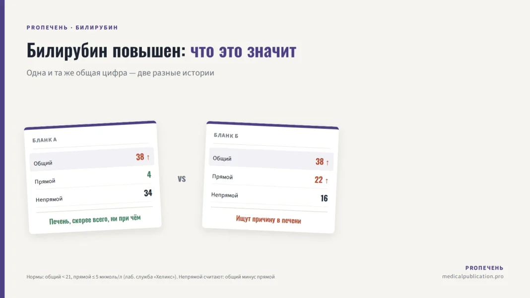 Два лабораторных бланка с одинаковым общим билирубином 38, но разным прямым — 4 и 22, показывающие разную причину повышения