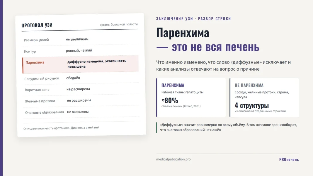 Фрагмент протокола УЗИ печени с подсвеченной строкой «Паренхима: диффузно изменена, эхогенность повышена»; справа две карточки — паренхима как рабочая ткань из гепатоцитов, около 80% объёма, и не паренхима: сосуды, желчные протоки, строма, капсула