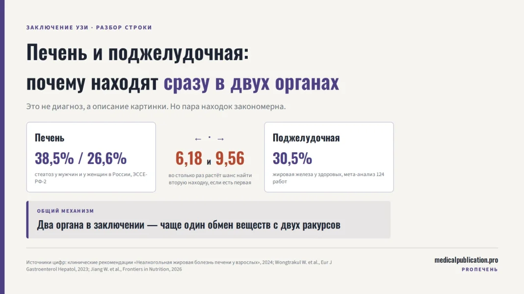 Схема связи двух органов: слева карточка «Печень» с цифрами 38,5% и 26,6% — распространённость стеатоза у мужчин и женщин в России, справа карточка «Поджелудочная» с цифрой 30,5% — доля жировой железы у здоровых, между ними двусторонние стрелки и числа 6,18 и 9,56, показывающие во сколько раз растёт шанс второй находки при первой; снизу плашка «Общий механизм»