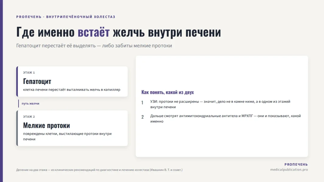 Схема двух уровней застоя желчи внутри печени: гепатоцит и мелкие желчные протоки