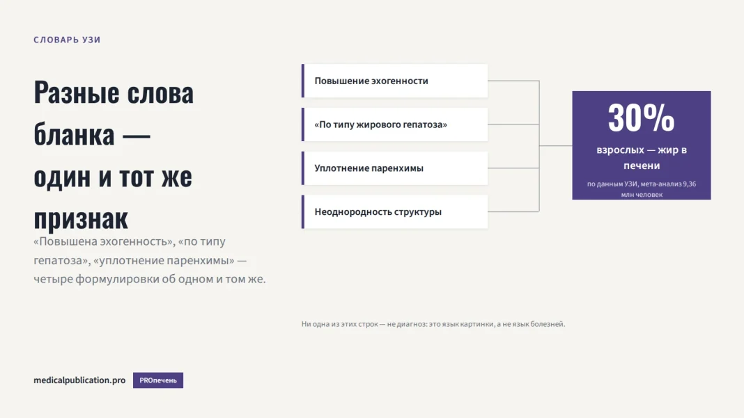 Схема: четыре формулировки заключения УЗИ печени (повышение эхогенности, по типу жирового гепатоза, уплотнение паренхимы, неоднородность структуры) сходятся стрелками к одному выводу — жир в печени есть у 30% взрослых