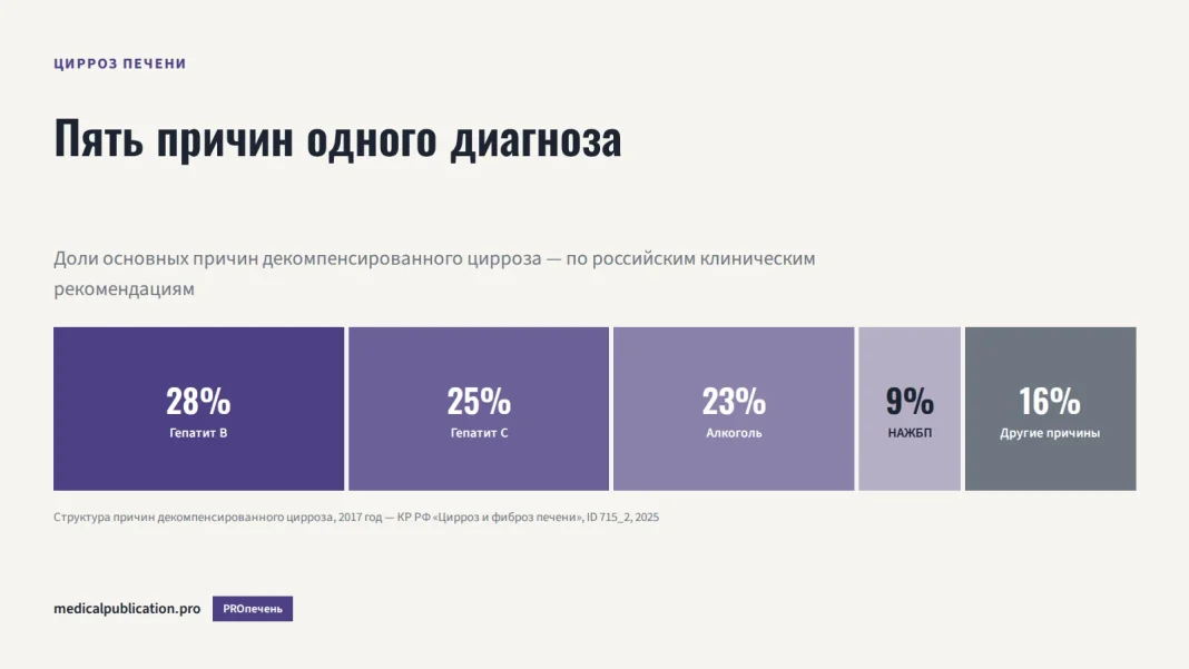 Диаграмма долей причин декомпенсированного цирроза: гепатит B 28%, гепатит C 25%, алкоголь 23%, НАЖБП 9%, другие причины 16%