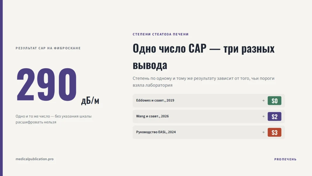 Цифра 290 дБ/м и три карточки: по порогам Eddowes 2019 это S0, по Wang 2026 — S2, по руководству EASL 2024 — S3