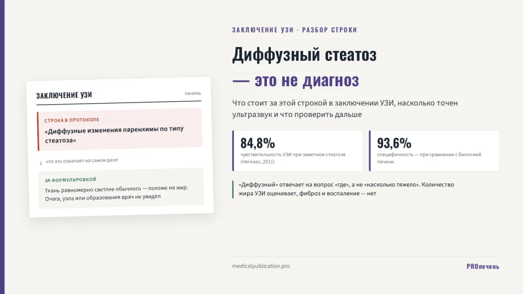 Строка «диффузные изменения по типу стеатоза» из заключения УЗИ с расшифровкой, что это не диагноз, и цифрами чувствительности и специфичности ультразвука
