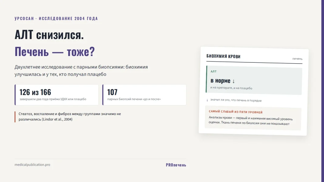 Лабораторный бланк с результатом АЛТ «в норме» рядом с цифрами исследования 2004 года: биохимия улучшилась и на плацебо, ткань печени по биопсии не изменилась