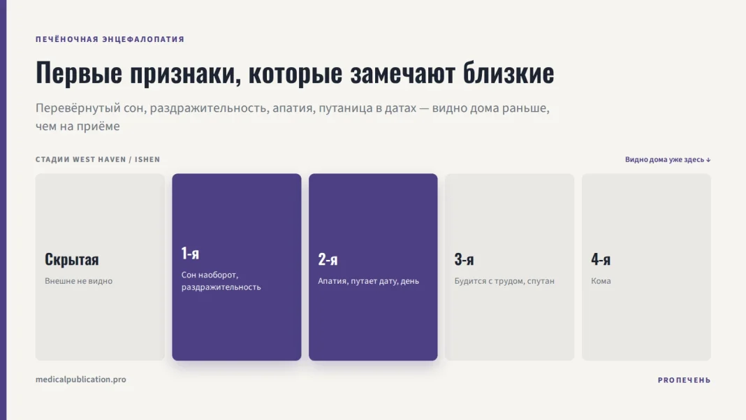 Шкала 5 стадий печёночной энцефалопатии West Haven/ISHEN с подсвеченными 1-й и 2-й стадиями: перевёрнутый сон, раздражительность, апатия и путаница в датах