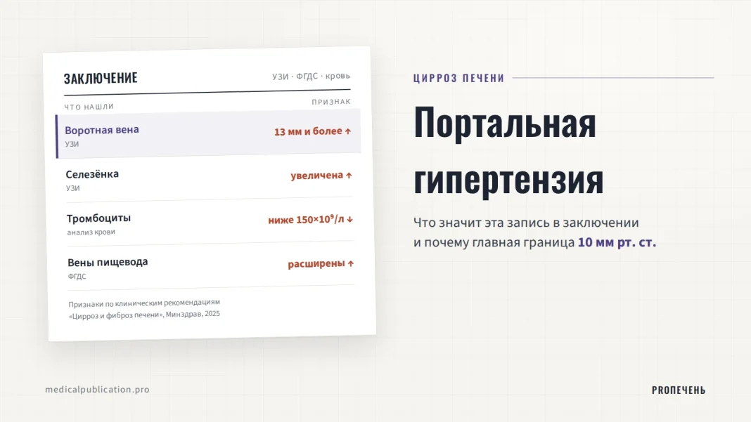 Бланк заключения УЗИ и ФГДС с признаками портальной гипертензии: воротная вена 13 мм и более, увеличенная селезёнка, тромбоциты ниже 150×10⁹/л, расширенные вены пищевода