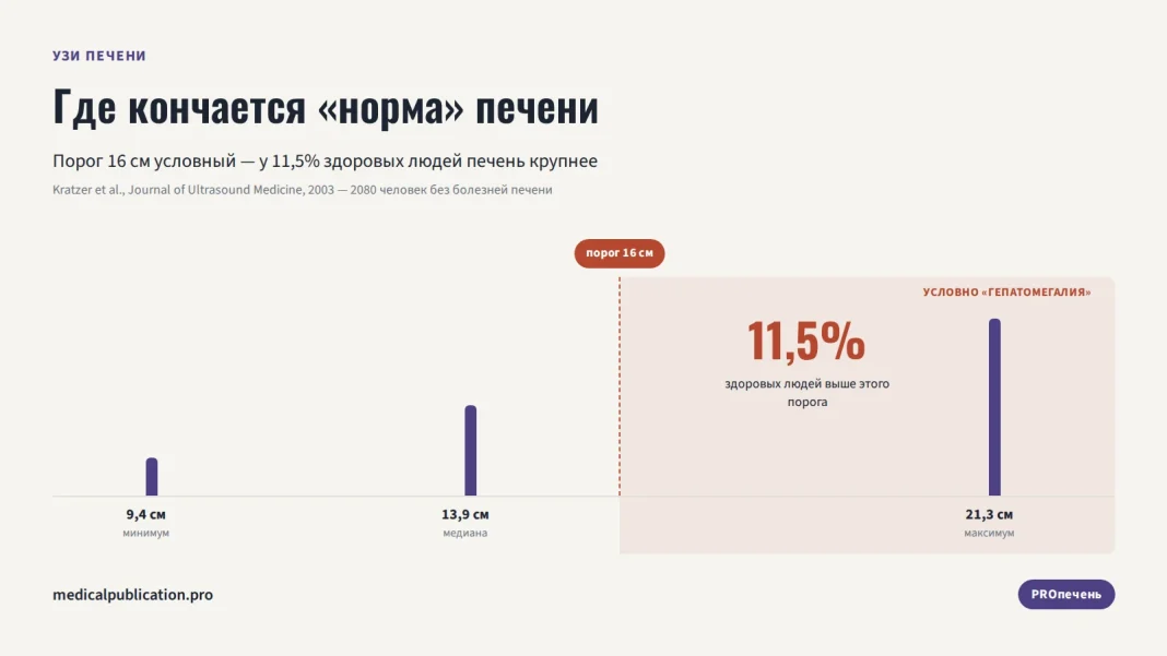 Шкала размера печени от 9,4 до 21,3 см с условным порогом 16 см и статистикой: у 11,5% здоровых людей печень крупнее этого порога