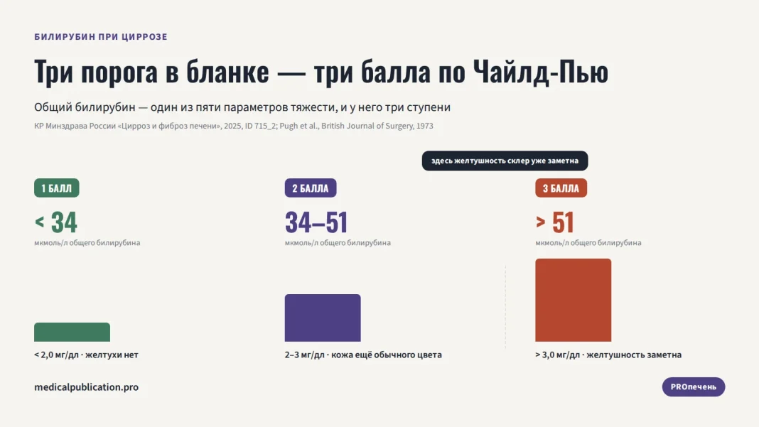 Три порога общего билирубина (менее 34, 34–51, более 51 мкмоль/л) и соответствующие им баллы по шкале Чайлд-Пью — 1, 2 и 3