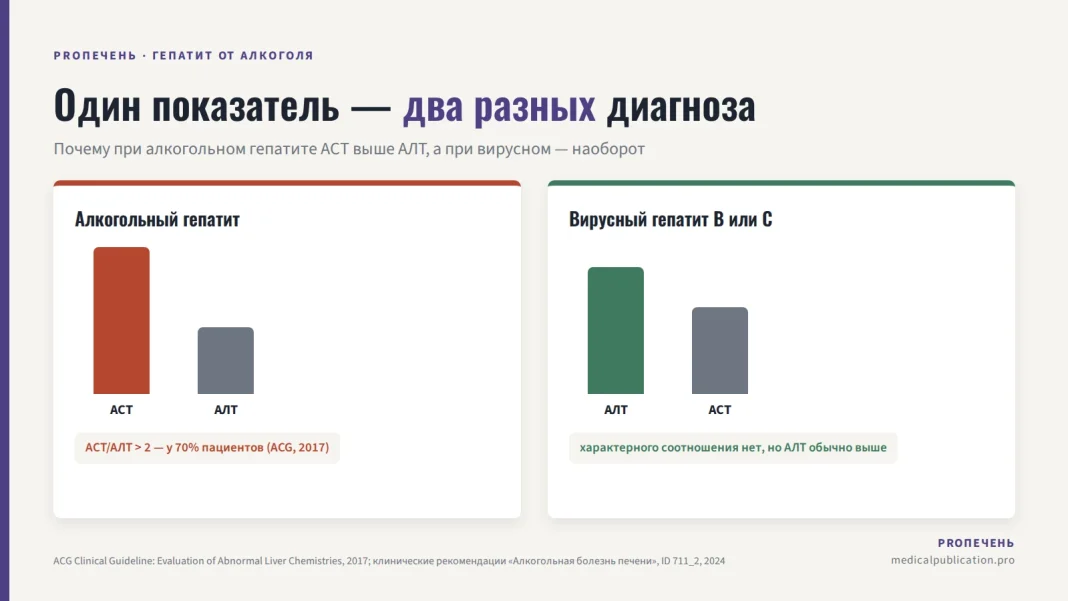 Два столбца с диаграммами: при алкогольном гепатите АСТ выше АЛТ, при вирусном — наоборот